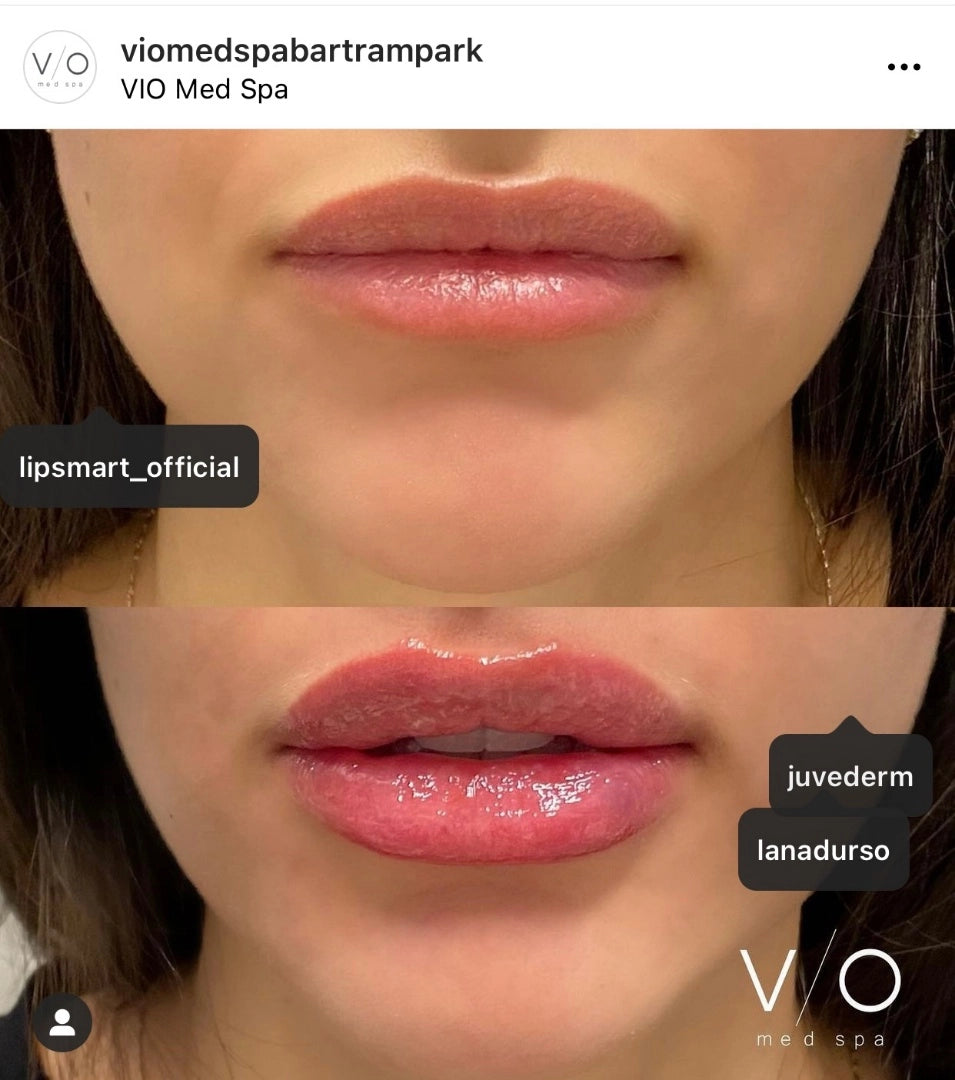 Lipsmart Hydrating Lip Treatment image 6