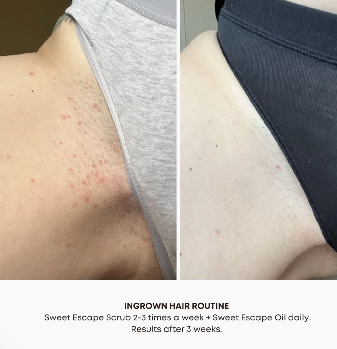 Bushbalm Ingrown Hair Oil image 3