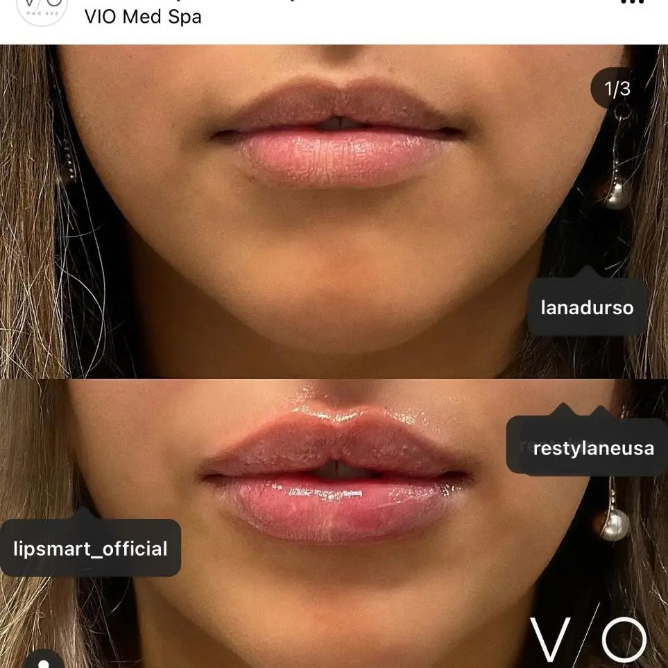 Lipsmart Hydrating Lip Treatment image 1