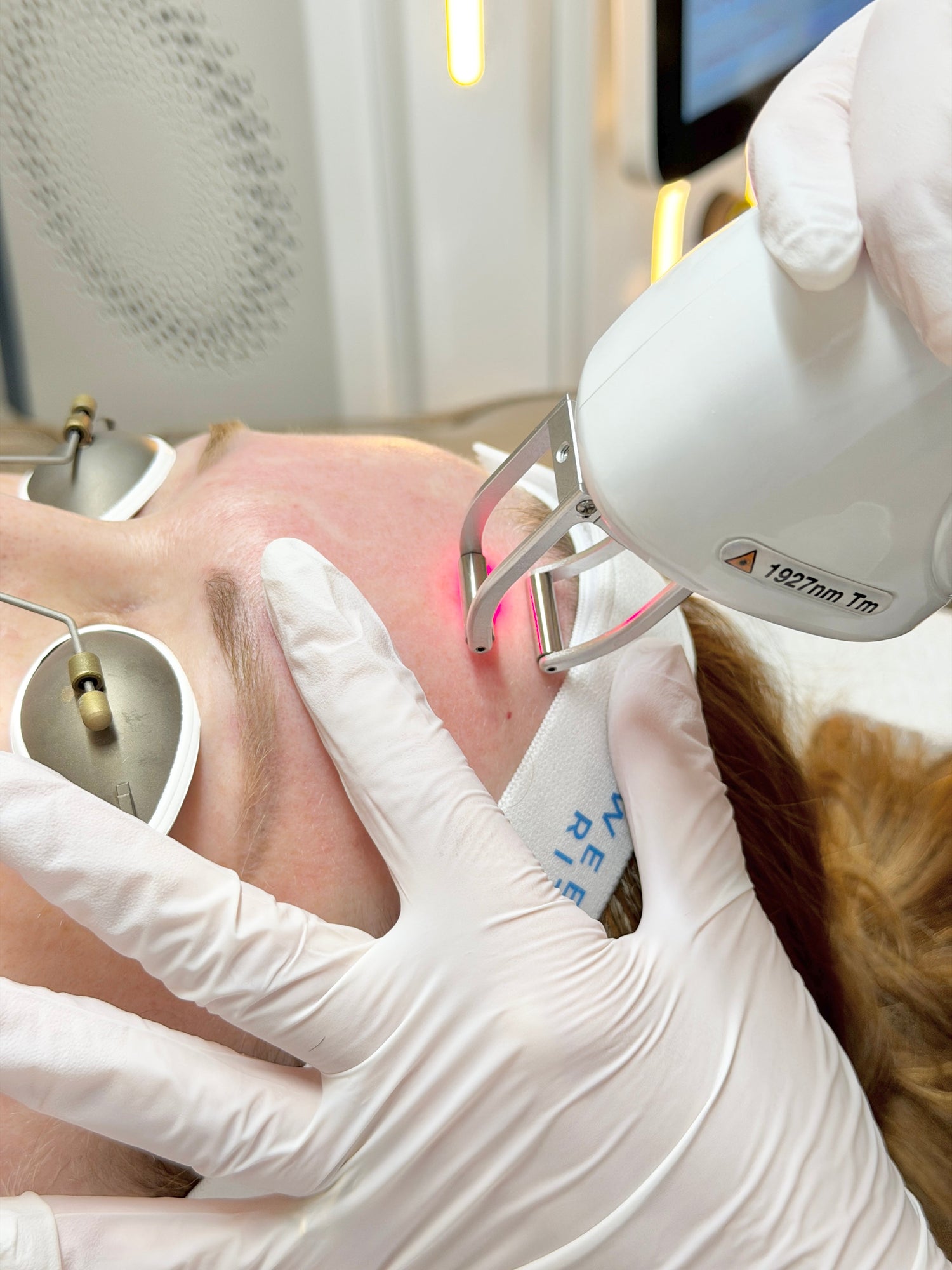 Laser Skin Resurfacing: Benefits, Downtime, Healing, and What To Expect