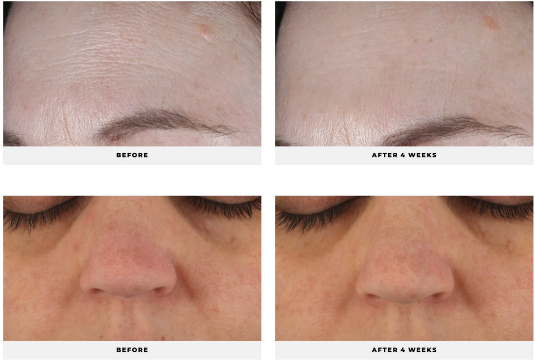 Overtime