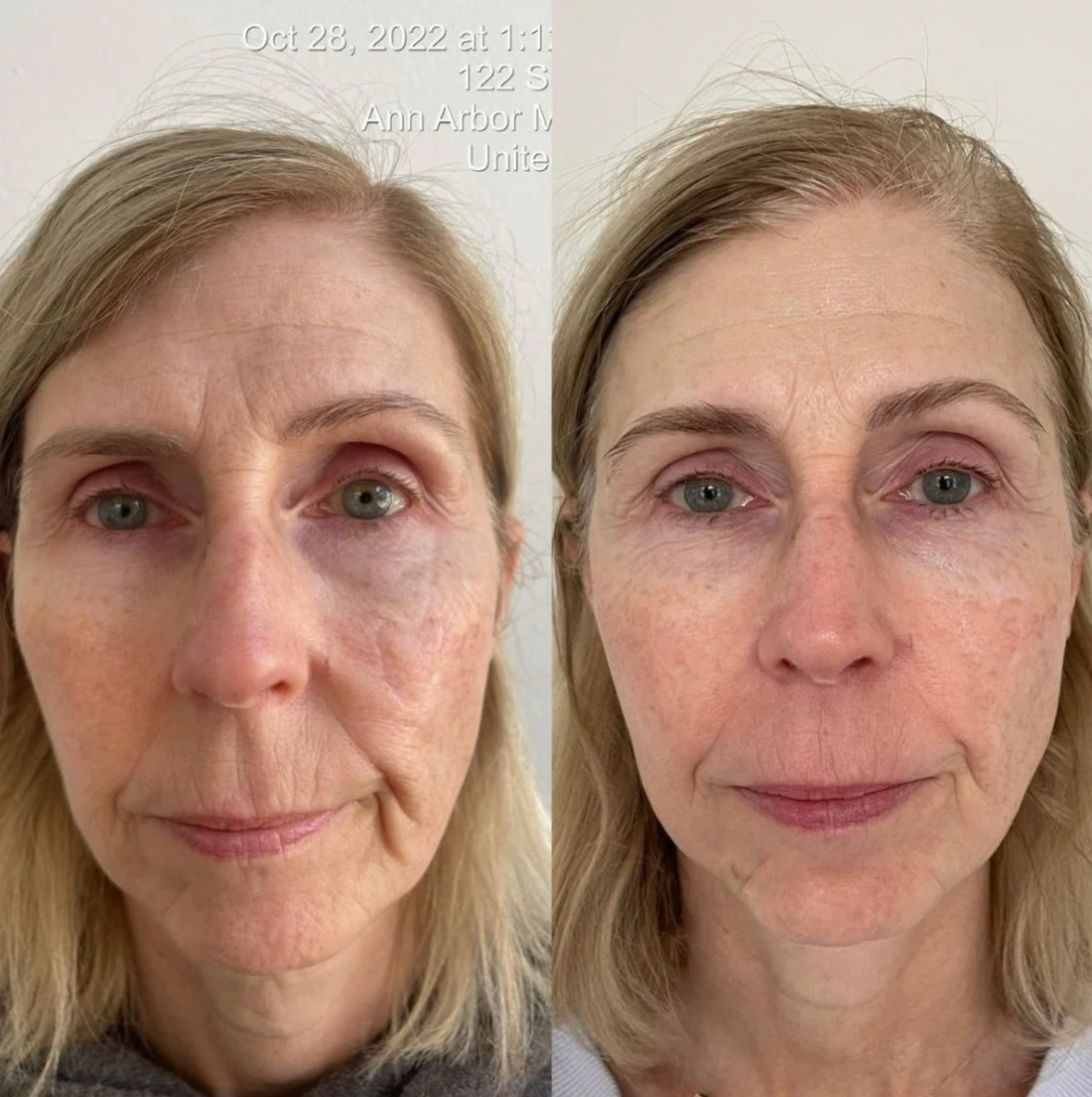 KrX Youthplex Face Lift Cleansing Fluid image 1