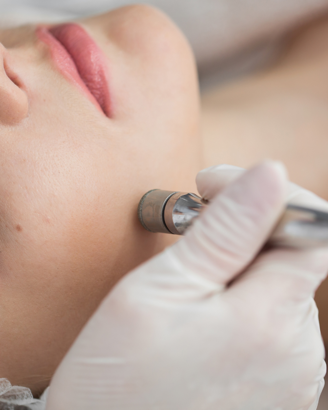 The microglow facial
